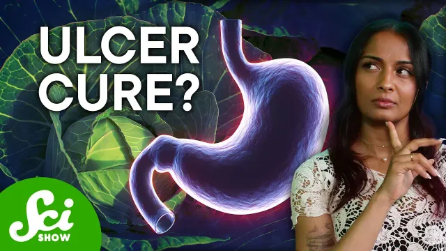 The Cure for Ulcers Is ... Cabbage